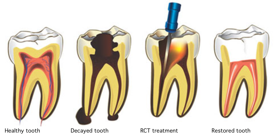 Conservative Dentistry and Endodontic