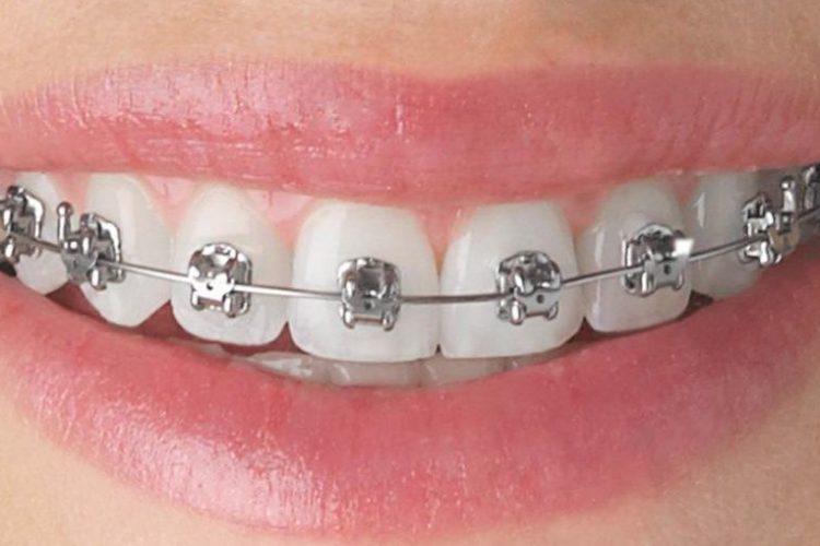 Orthodontic treatment services in Lucknow