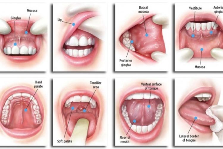 Screening for Oral cancer Patient Jankipuram